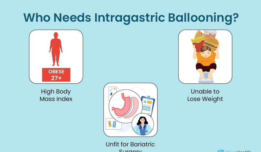 Who Needs Intragastric Ballooning?